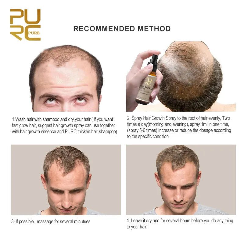 30ml hair growth spray bottle with ginger ginseng polygonum and grape seed oil for scalp and hair roots