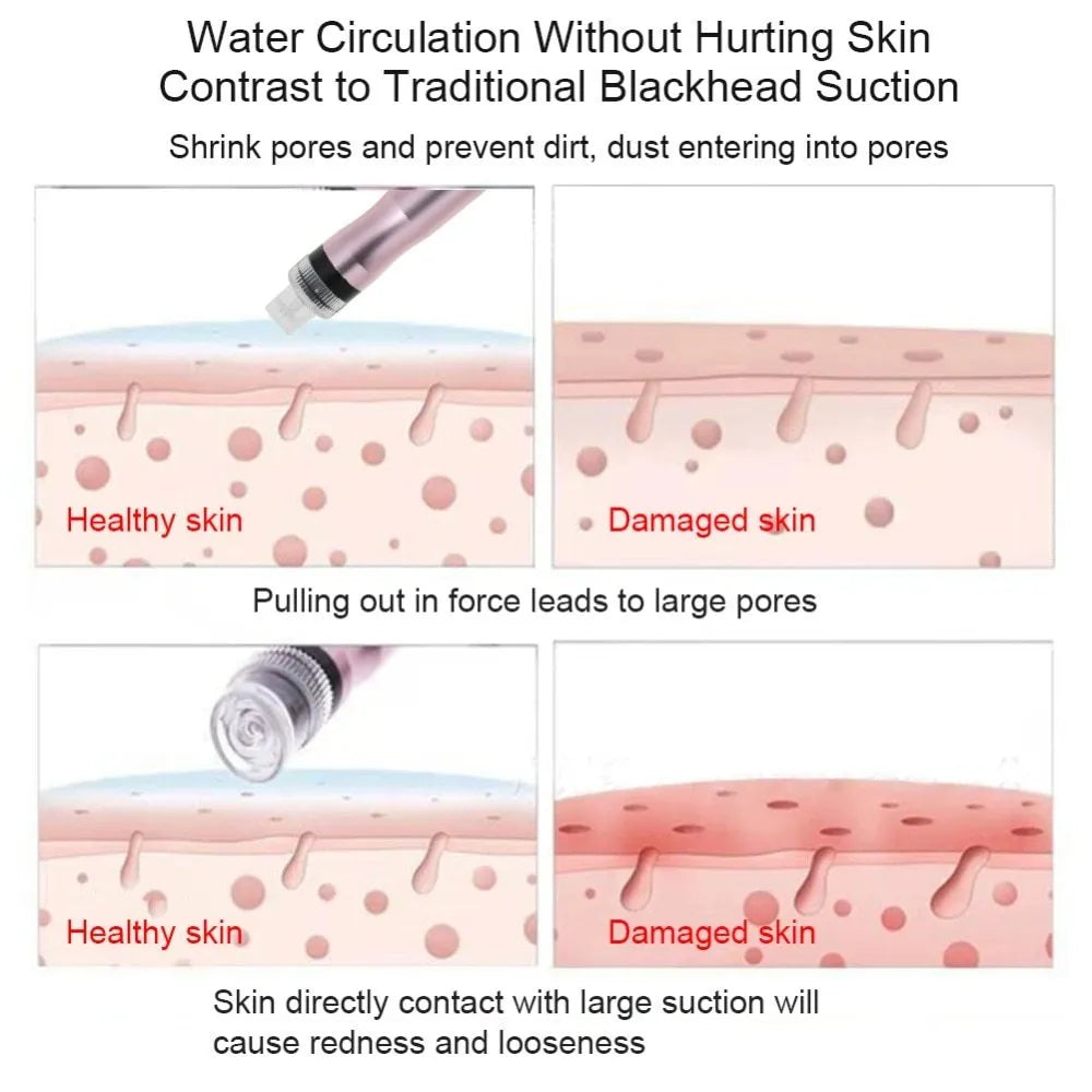 Portable oxygen spray hydro jet machine for facial blackhead removal skin rejuvenation 26cm with bottles and crystal heads