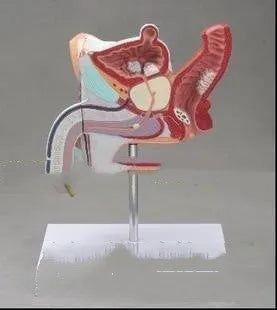 Anatomical model of male reproductive system showing prostate hyperplasia and other pathologies