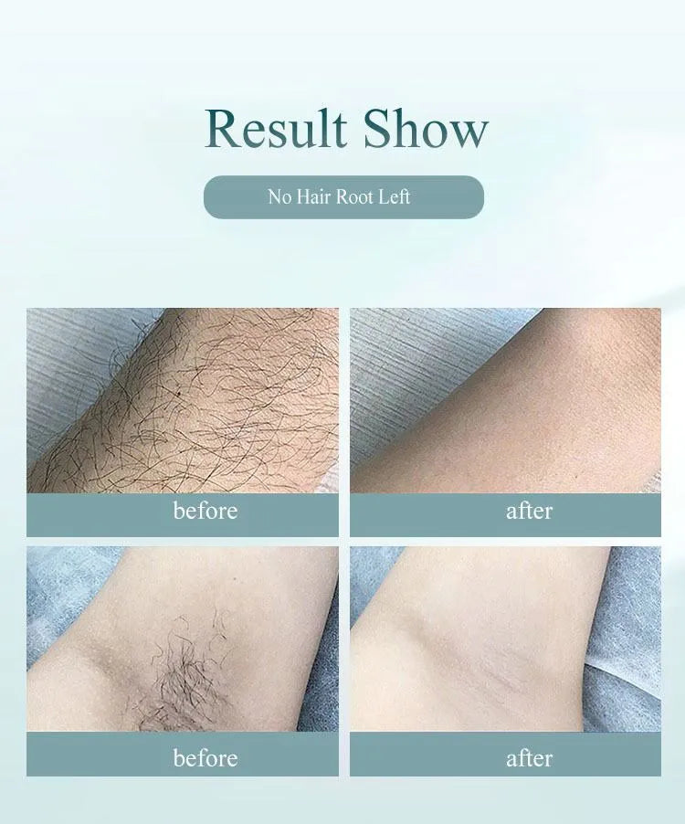 Compact laser hair removal device with 999999 flashes and 1-8 power levels, shown in green, with skin rejuvenation and acne reduction features.