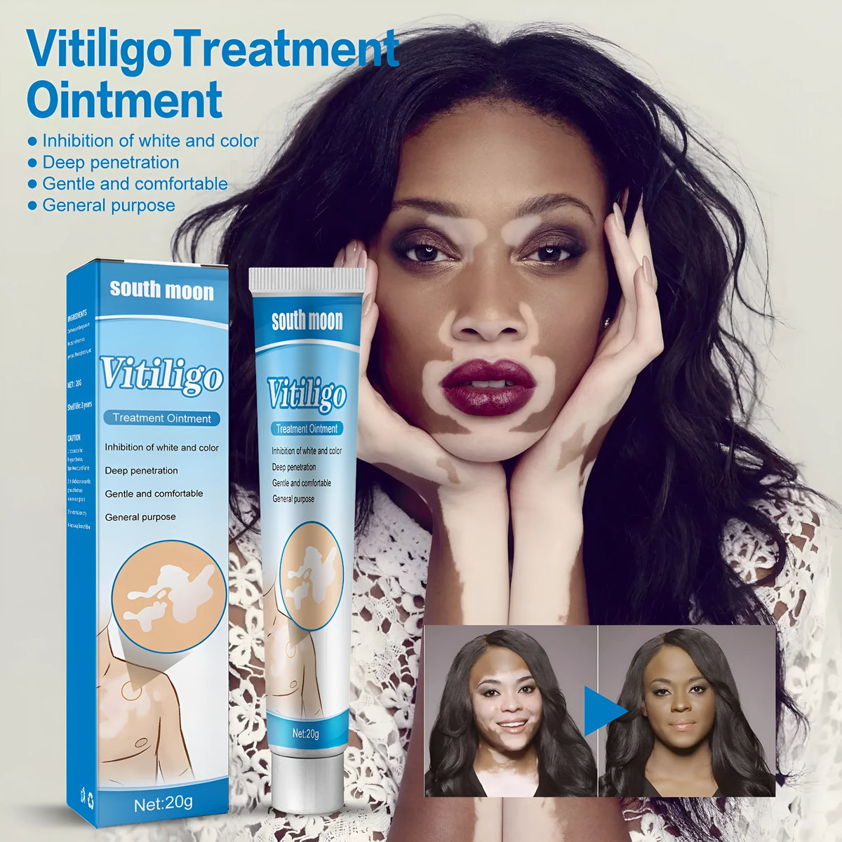White flower spot sweat spot care ointment in a 20g boxed format for targeted skin spot care