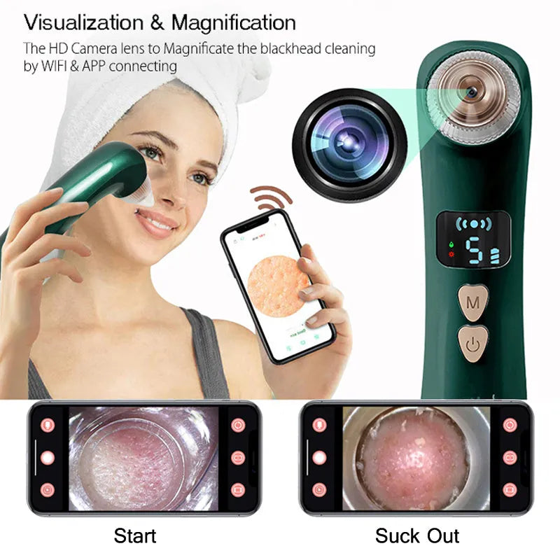 Green heating blackhead instrument with hot compress mode and app control on a white background