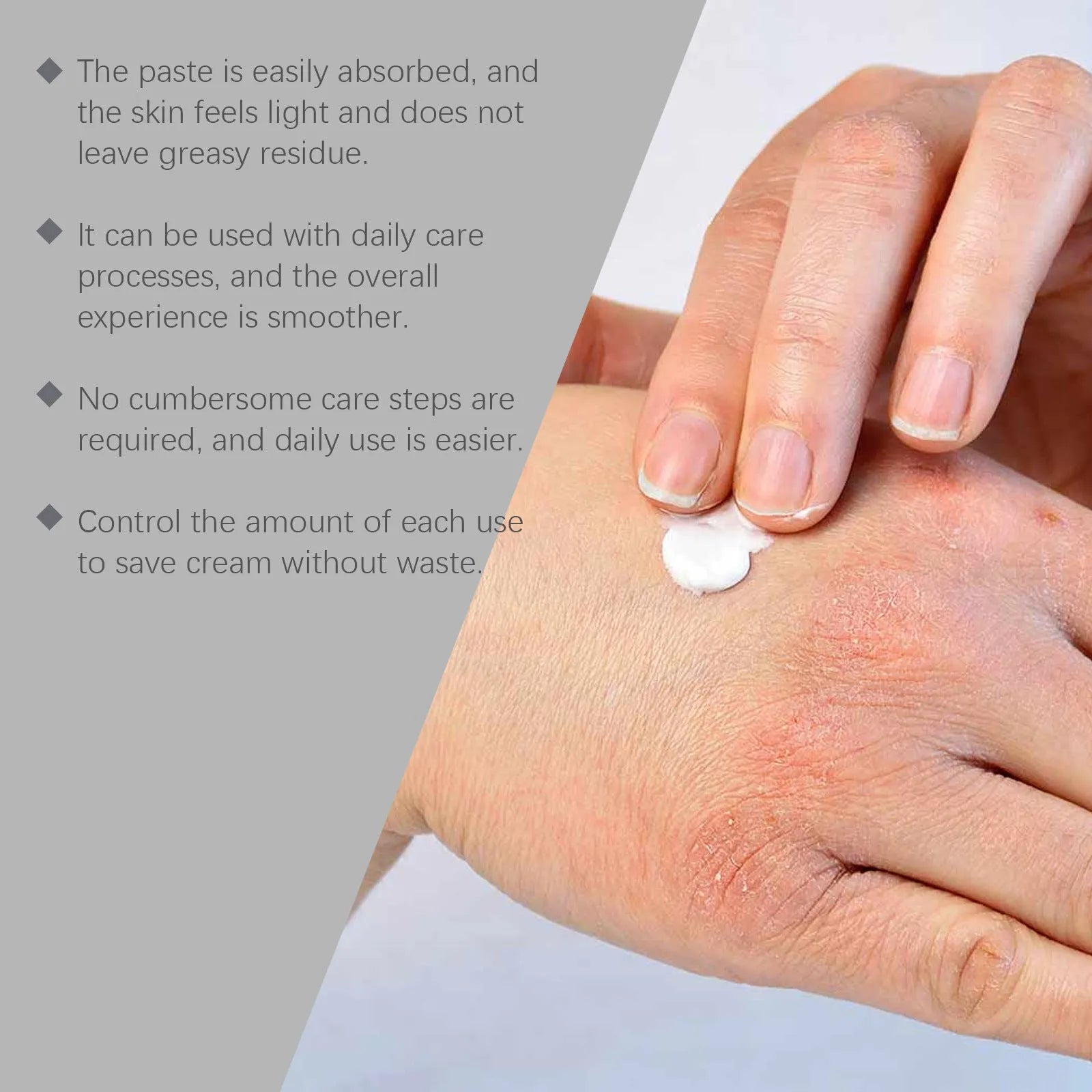 75g container of bifidobacterium and mint leaf neck repair cream