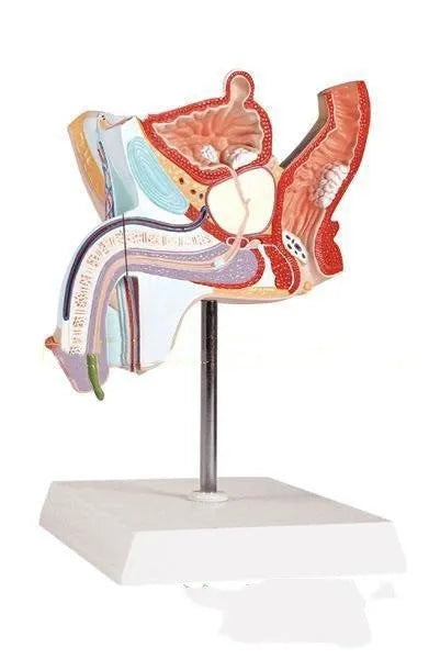 Anatomical model of male reproductive system showing prostate hyperplasia and other pathologies