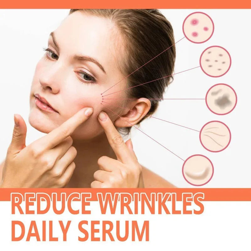 30ml rose essential oil serum bottle for facial brightening and wrinkle smoothing