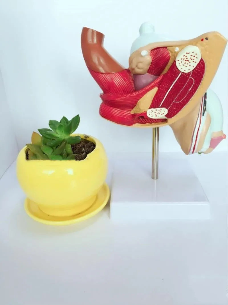 Anatomical model of male reproductive system showing prostate hyperplasia and other pathologies
