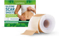 Roll of silicone scar sheet measuring 4cm wide with tea tree oil and aloe extract for scar treatment