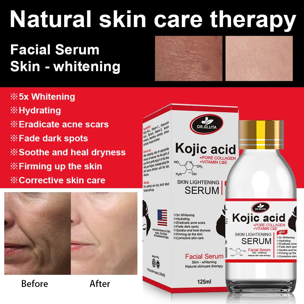 125ml kojic acid serum bottle for skin lightening, uneven skin tone and dull skin, natural skin care therapy