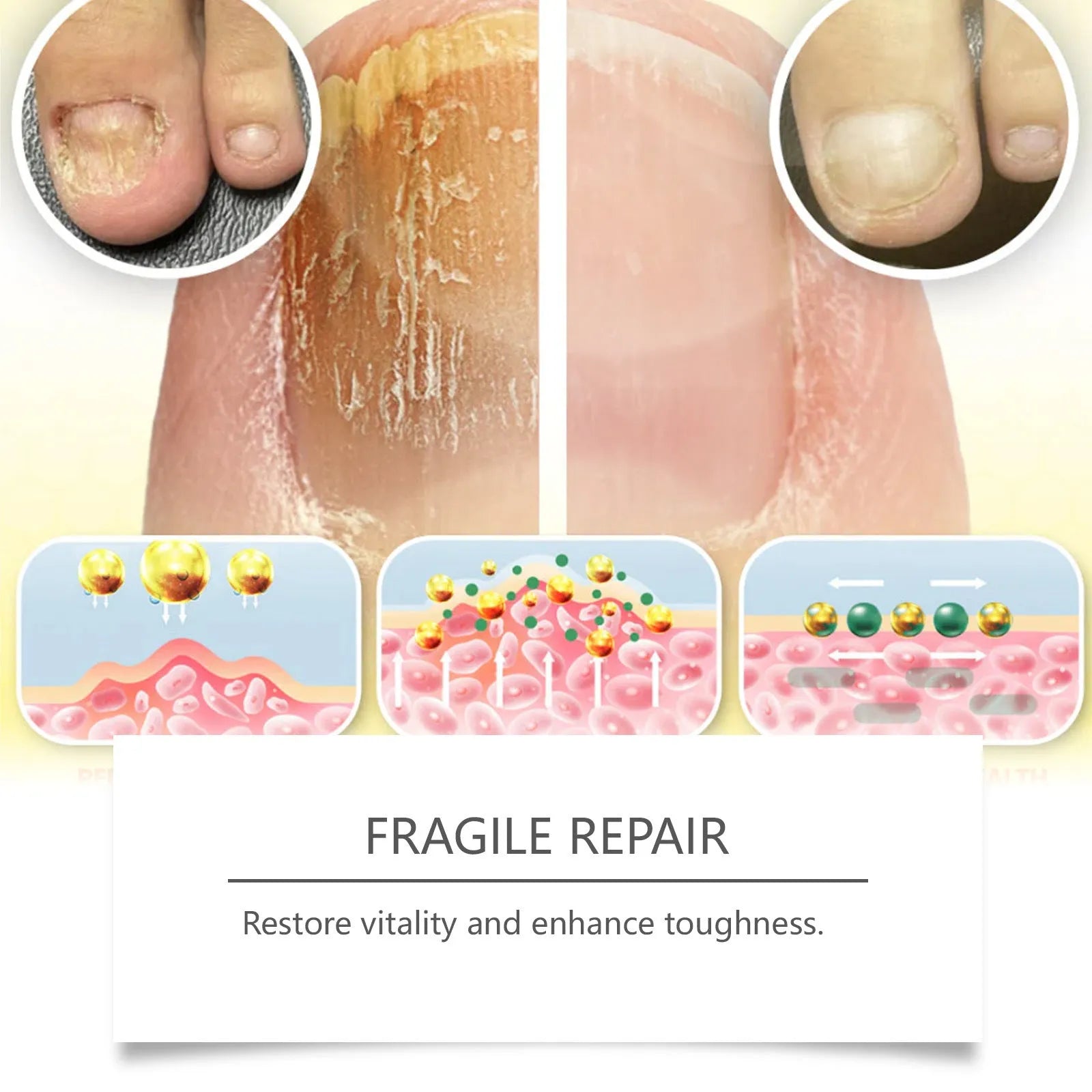 50ml bottle of nail care solution with bee venom and peppermint oil for nail fungus treatment