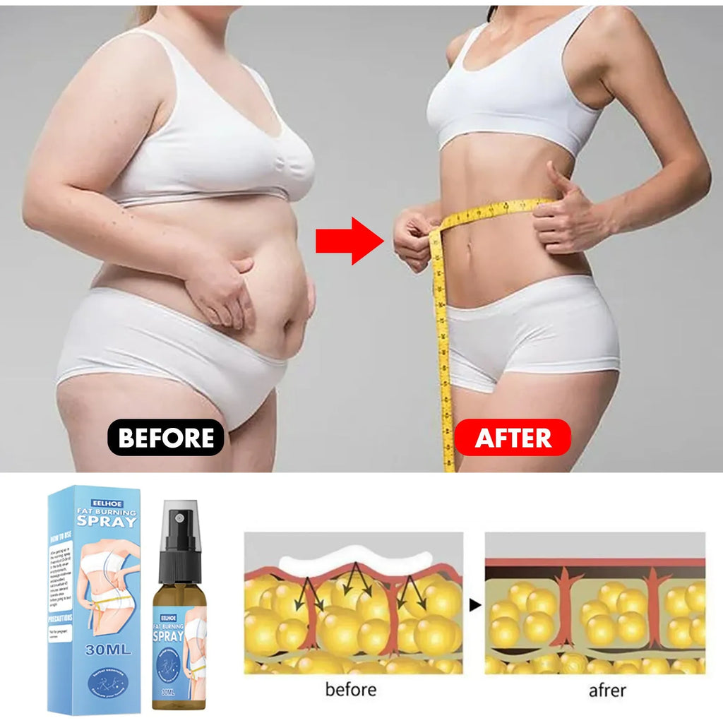 30ml body shaping spray bottle with box, 10.5cm x 2.7cm, wild hawthorn and chrysanthemum mother formula