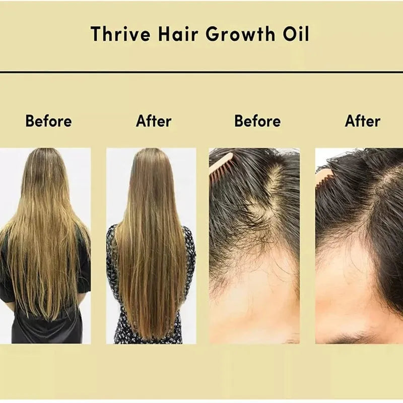 60ml bottle of yellow rosemary hair care essential oil for split ends and perm damage treatment